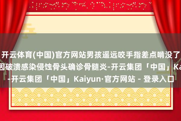 开云体育(中国)官方网站男孩遥远咬手指差点啃没了！ 肿痛二十余天 已因破溃感染侵蚀骨头确诊骨髓炎-开云集团「中国」Kaiyun·官方网站 - 登录入口